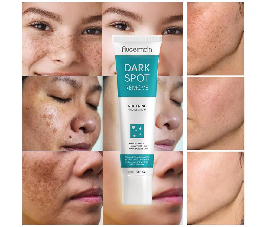 Benutzer definierte Logo Gesichts pflege Dark Spot Remover Creme Reparatur Haut Melanin Melasma Entfernung Hautpflege Anti-Aging Sommersprossen White ning Cream
