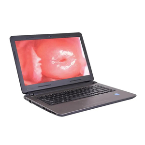 Colposcope numérique pour gynécologie, caméra électronique de colposcopie vidéo pour <span class=keywords><strong>vagin</strong></span> - Product Image 5