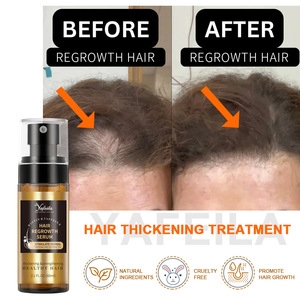 <span class=keywords><strong>Spray</strong></span> <span class=keywords><strong>tonico</strong></span> per la crescita dei capelli con biotina al rosmarino che ripara i capelli e si allontana - Product Image 2
