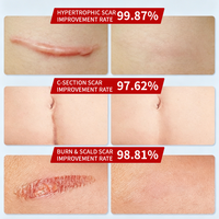 Gel Cicatrisant Avancé Vitamine C Acide Hyaluronique Atténuation des Marques d'Acné Vergetures Lissage de la Peau Essence Visage et Corps