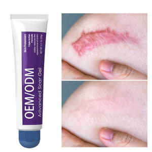 OEM قابل للتخصيص جل ندبة متقدم للندوب القديمة والجديدة إمدادات الرعاية الصحية المتقدمة - Product Image 1