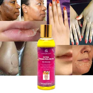 OEM Orange Peeling Oil für Gesicht und Körper Extra Strength Yellow Peeling Oil
