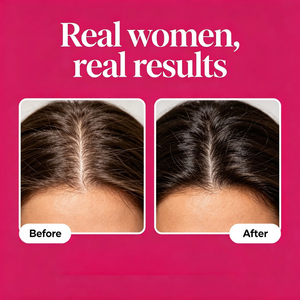 Tabletas de Suplemento Dietético para el Crecimiento del Cabello OEM ODM, Mejoran la Zona Ancha del Cabello y la Línea del Cabello que se Recede, y Fortalecen el Cabello Seco y Quebradizo - Product Image 3