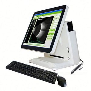 SYA041-2 phòng khám quang học nhãn khoa siêu âm AB Scanner A B scan với Built-in máy tính - Product Image 1