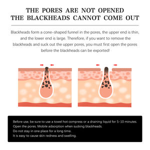 Parches Nasales de Perlas al por Mayor para Limpieza Profunda del Acné y Eliminación de Puntos Negros, Tiras Eficaces para Eliminar Puntos Negros - Product Image 4