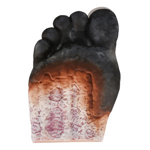 IPA medis <span class=keywords><strong>Diabetes</strong></span> Model Pegboard anak, untuk demonstrasi Pendidikan - Product Image 6