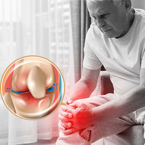 South Moon 30ml Bienengift-Schmerzmittel-Spray zur Linderung von Kniebeschwerden und Gelenkbeschwerden, beruhigendes Spray für Knieschmerzen - Product Image 3