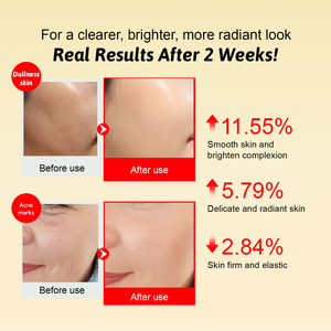 Sérum Visage Éclaircissant à la Vitamine C OEM – <span class=keywords><strong>Correcteur</strong></span> Anti-Taches Brunes et Hyperpigmentation pour une Peau Éclatante – Soin de la Peau Marque Privée - Product Image 6