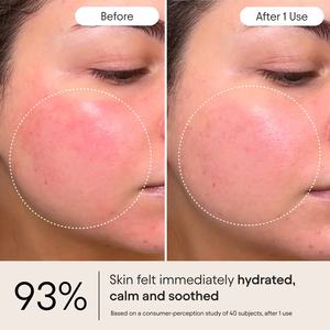 Crème réparatrice de la barrière cutanée personnalisée, complexe de 5 céramides, super peptides, baie fantôme, réparation de la barrière, hydratation, OEM, crème hydratante pour le <span class=keywords><strong>visage</strong></span> contre l'eczéma - Product Image 4