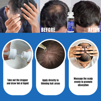 Lot de Sérums Capillaires à 5% de Biotine pour la Croissance des Cheveux et le Traitement de la Chute de Cheveux, 60ml – Huile de Croissance Capillaire pour une Pousse Rapide des Cheveux