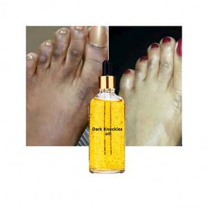 Sérum éclaircissant pour la peau, élimine les taches noires, uniformise le teint, pour les articulations <span class=keywords><strong>des</strong></span> doigts, fourni par Cosmetics - Product Image 1