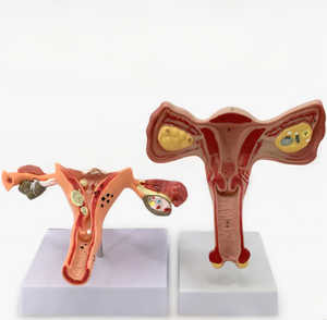 Mannequin de formation en gynécologie modèle d'utérus <span class=keywords><strong>3D</strong></span> réaliste outil d'enseignement anatomiquement précis équipement de formation scolaire en médecine - Product Image 5