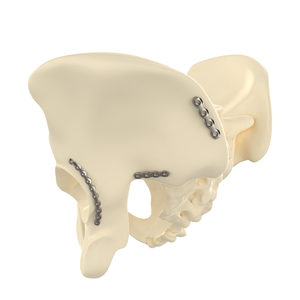 CANWELL CE/ISO gecertificeerde roestvrijstalen orthopedische trauma 3,5 mm bekkenvergrendelingsplaat gebogen botfixatie implantaat anatomisch - Product Image 3