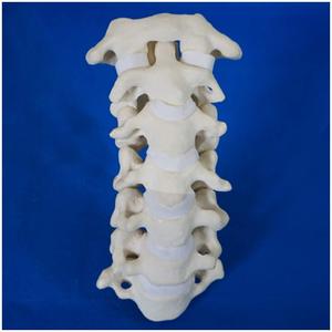 Modèle anatomique de la colonne cervicale C1 à C7 en mousse solide KyrenMed pour la pratique de la chirurgie orthopédique - Product Image 5