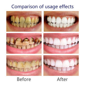 Poudre dentifrice blanchissante au <span class=keywords><strong>charbon</strong></span> actif de marque privée pour un nettoyage en profondeur, l'élimination des taches et une haleine fraîche - Product Image 5