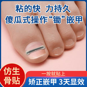 Parche Óseo Biónico <span class=keywords><strong>de</strong></span> Aleación <span class=keywords><strong>de</strong></span> Titanio Nie, <span class=keywords><strong>Corrector</strong></span> <span class=keywords><strong>de</strong></span> Inflamación con Ranura para Clavos <span class=keywords><strong>de</strong></span> Acero con Memoria - Product Image 4