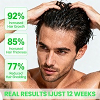 Shampoo activateur de racines pour hommes, gingembre, réglisse, traitement anti-chute de cheveux, shampooing à base de plantes pour la croissance des cheveux
