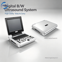 Appareil d'échographie portable noir et blanc avec écran de 12,1 pouces, scanner d'échographie numérique 2D pour hôpital et clinique