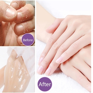 ทรีทเมนต์บำรุงมือดรายแฮนด์สปา เชียบัตเตอร์ น้ำมันโจโจ้บา วิตามินอี บิวตี้ ไฮเดรตติ้ง มอยส์เจอไรซิ่ง แฮนด์มาส์ก - Product Image 6