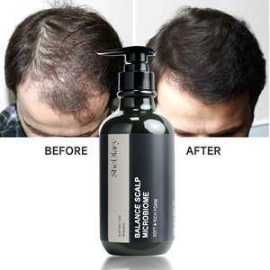 Champú en crema vegana suave, <span class=keywords><strong>bloqueador</strong></span> de DHT para el crecimiento del cabello, cuidado del cuero cabelludo, fortalecimiento de los folículos, tratamiento anticaída para adelgazar - Product Image 2