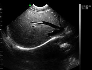 Konted MDR Diagnóstico Cor Sem Fio Micro Convexo C10RS Portátil para Emergência Médica - Product Image 6