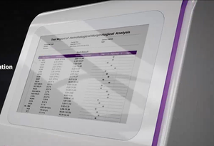 DX-A1 tất cả-trong-một thú y thiết bị chẩn đoán máu nước tiểu Phân Analyzer với tế bào đếm viêm giám sát CRP - Product Image 3