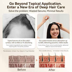 Le plus récent Micro <span class=keywords><strong>Needle</strong></span> DRS Derma Stamp Bio <span class=keywords><strong>4</strong></span> Aiguilles Dispositif de soins de la peau élevé - Product Image 6