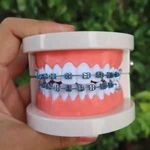 Moda rimovibile bretelle dentali gioielli in acciaio inox decorazione per adulti ragazzi asiatico sorriso accessori - Product Image 2