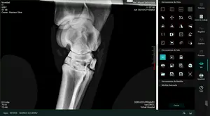 Équipement de radiologie médicale 17*17 Machine à rayons X Portable numérique sans fil détecteur à écran plat prix pour une utilisation humaine ou vétérinaire - Product Image 6