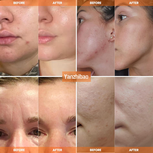 Crème hydratante pour la peau OEM avec du rétinol et de la mucine d'escargot pour la réparation, l'éclaircissement et la revitalisation - Product Image 3