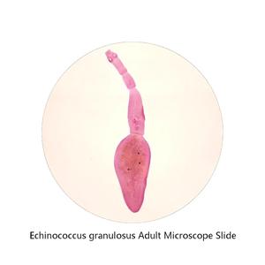 Portaobjetos de microscopio preparados con parásitos teñidos y transparentes, portaeobjetos de microscopio con lombrices adultas de Echinococcus Granulosus para la educación en ciencias médicas - Product Image 1