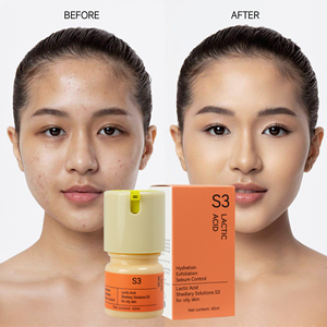 40ml Melkzuur Gezichts Serum Exfolierend Verhelderend Huidverzorging Anti-veroudering Donkere Vlekken Corrector met Hydraterende Verlichtende Eigenschappen - Product Image 1