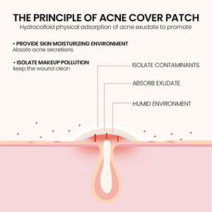 Patchs anti-acné 40 étoiles les plus vendus pour couvrir les imperfections et les boutons du visage - Product Image 4