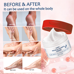 Crème réparatrice pour les pieds KOEC 40% d'urée 100g Vente en gros Crème hydratante pour les mains et les pieds pour les talons et les pieds secs et fissurés <span class=keywords><strong>Antifongique</strong></span> - Product Image 5