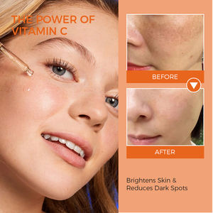 privée Vitamine <span class=keywords><strong>C</strong></span> VC Blanchiment Essence de peau plus serrée et plus brillante Sérum de soin de la peau anti-âge pour le visage - Product Image 5