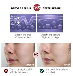 100% Natural orgánico OEM Retinol <span class=keywords><strong>Facia</strong></span> cuidado vitamina A vitamina C hidratante blanqueamiento antiarrugas reafirmante <span class=keywords><strong>crema</strong></span> facial - Product Image 4