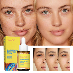 Recommandation de <span class=keywords><strong>vente</strong></span> chaude - Sérum éclaircissant pour le visage MELAO, élimine les taches et corrige les décolorations, à base de niacinamide - Product Image 2