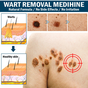 Healthcare Supply 100% Natural Herbal <strong>Genital</strong> <strong>Wart</strong> Treatment Cream Vitamin E Skin <strong>Genital</strong> Removal Cream - Product Image 5