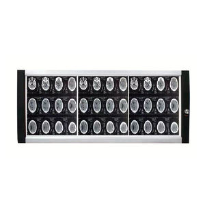 Ein/Doppel/Drei/Vier-Bildschirme zahnärztliches superschlankes Negatoskop LED-Röntgenfolie-Ansichtlicht - Product Image 1