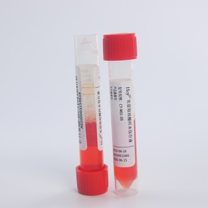 Solución de Preservación de Ácidos Nucleicos Hua Chenyang CY-M02-09, Vial de Muestra Estéril de Grado Médico - Product Image 1