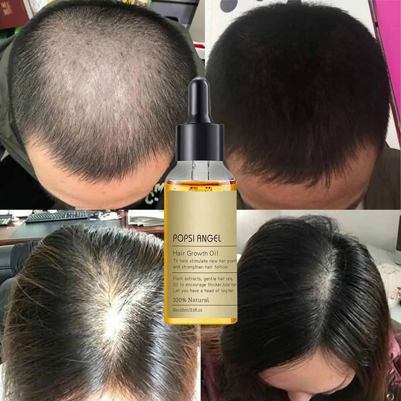 Conjunto de champú y acondicionador para el crecimiento del cabello OEM personalizado de fábrica, venta al por mayor, antipérdida de cabello, romero, reparación del cabello