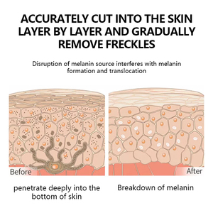 Suero de Cúrcuma con Ácido Kójico de Marca Privada, Suero Corrector de Manchas Oscuras, Suero Facial Iluminador Antienvejecimiento para un Tono de Piel Uniforme - Product Image 4