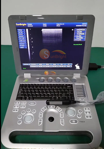 Máquina de Ultrasonido Portátil Fácil de Usar para Hospitales Veterinarios - Product Image 2