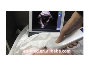 Scanner de vessie à ultrasons sans fil à haute vitesse (2s), mini scanner portatif 4d B10 - Product Image 3