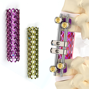 CANWELL Cages en maille de titane pour la colonne vertébrale, vis pédiaculaire thoracolombaire antérieur, réduction polyaxiale, chirurgie de la colonne vertébrale minimalement invasive - Product Image 1