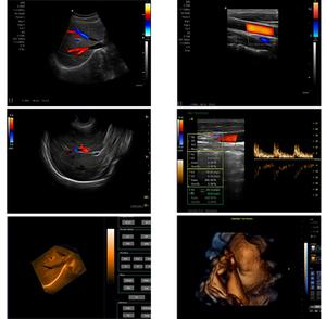Ecógrafo Veterinario <span class=keywords><strong>Mindray</strong></span> MX5, Sistema de Ultrasonido de Diagnóstico Portátil Completamente Digital de Alta Calidad con Pantalla de 15 Pulgadas para Uso Animal - Product Image 3