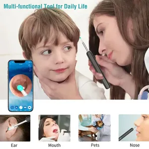 Cámara Limpiador de Oídos Inalámbrica Inteligente YINSTECH NE3 con Chip WiFi Dedicado, Visión LED, 5MP, ABS Portátil <span class=keywords><strong>y</strong></span> Batería de 160mAh - Product Image 6