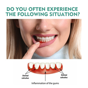 Alivie el Dolor de Muelas, el Dolor <span class=keywords><strong>Bucal</strong></span>, el Dolor de Encías Periodontales, las Úlceras Aftosas y las Bollosidades con esta Solución Antibacteriana en Aerosol para el Cuidado <span class=keywords><strong>Bucal</strong></span> - Product Image 5