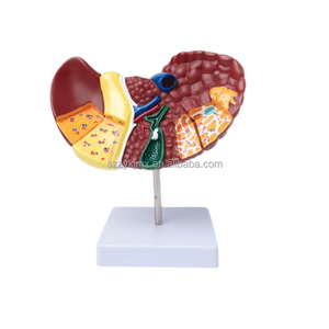 Modèle anatomique du foie pathologique humain pour l'école de médecine pour l'étude et la recherche sur les caractéristiques pathologiques du foie - Product Image 1