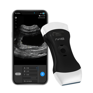 Draagbare Veterinaire Instrument Ultrasone Machine Met Gefaseerde Lineaire Convexe Transducers 1 Sonde Voor Diagnose Van Dieren - Product Image 1